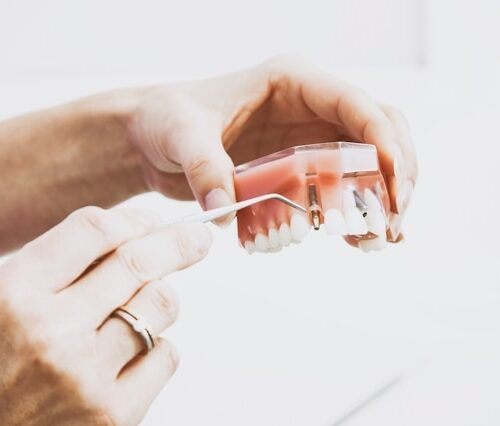 Tips for Getting New Dentures